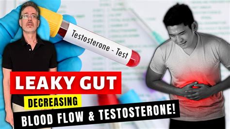 Leaky Gut Erectile Dysfunction Clogged Arteries Low Testosterone Delayed Ejaculation Due To
