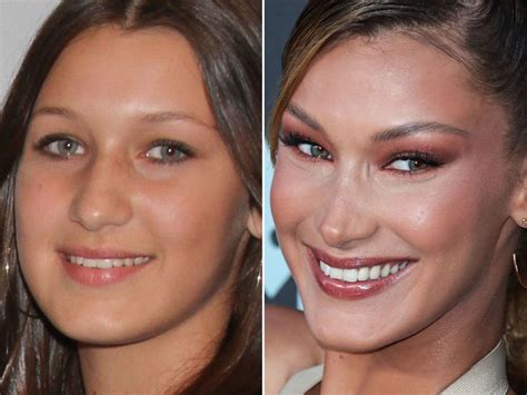 bella hadid before and after bella hadid bella hadid hair plastic surgery