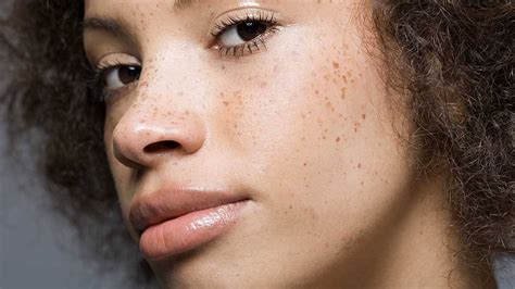 Freckles Story Of The Trend Beauty Backstage Tales