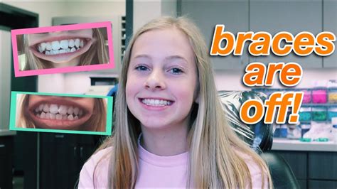 Getting My Braces Off Vlog Youtube