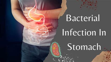 A Complete Guide To Bacterial Infection In Stomach Symptoms Treatment