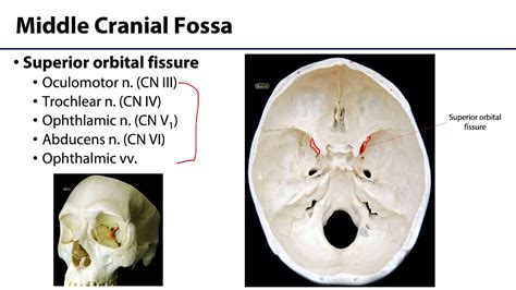 Cranial Cavity And Brain Lo Cranial Fossae Youtube