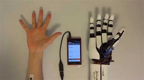 Handiii Accessible Myoelectric Hand Prosthesis YouTube