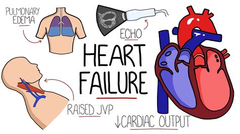 Heart Failure Explained HFrEF Vs HFpEF Systolic Vs Diastolic Heart