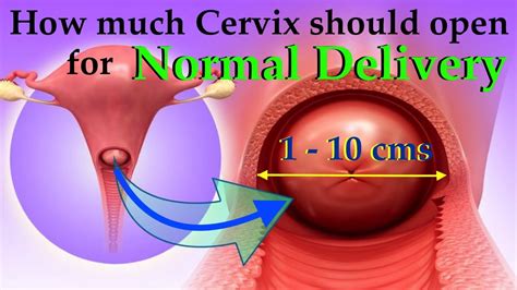 For Normal Delivery What Should Be The Size Of Cervix Youtube