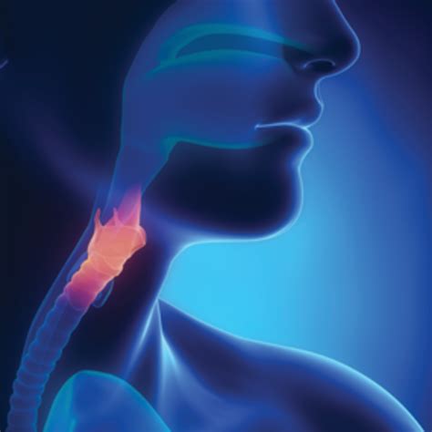 are you at risk understanding barrett s esophagus a womans health