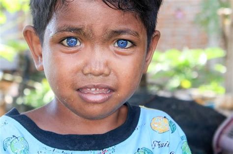 Punya Mata Biru Bak Bule Eropa Bocah Asli Indonesia Ini Viral