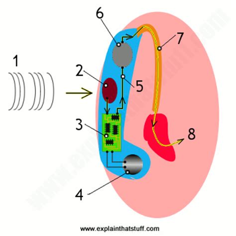 We did not find results for: How do hearing aids work? - Explain that Stuff