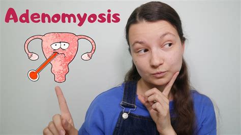5 Facts About Adenomyosis Youtube