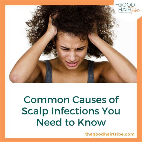 Common Causes Of Scalp Infections You Need To Know The Good Hair Tribe