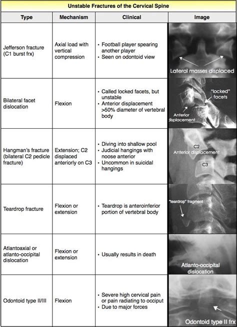 Rosh Review Unstable Fractures Of Cervical Spine With Images