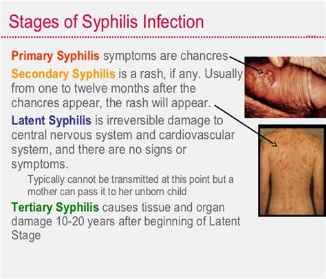 Syphilis Symptoms In Men Sign And Symptoms Of Syphilis In Men And Women Infographic How Does