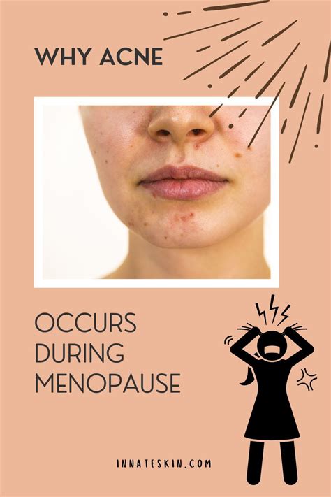 Pin On Acne After Menopause