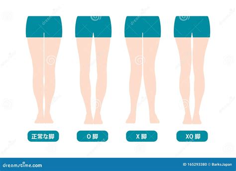 Difference Types Of Legs Angles And Knees Vector Illustration Normal