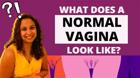 what does a normal vagina look like answers dr niveditha manokaran youtube