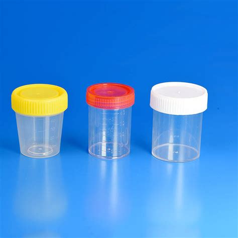 Medical Laboratory Sterile 60ml 90ml Urine Specimen Sample Collection