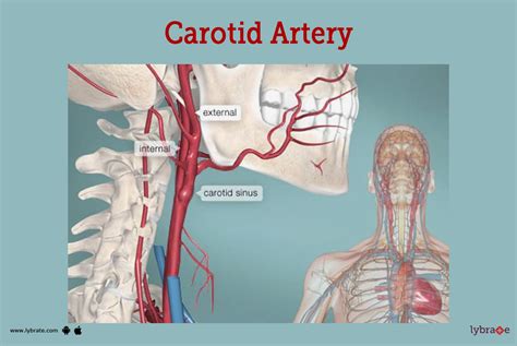 Carotid Artery Human Anatomy Picture Function Diseases Tests And