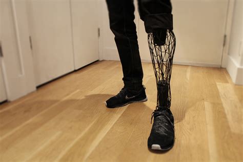 William Root Exo Prosthetic Leg