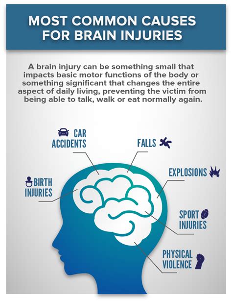 Most Common Causes For Brain Injuries Reyna Law Firm
