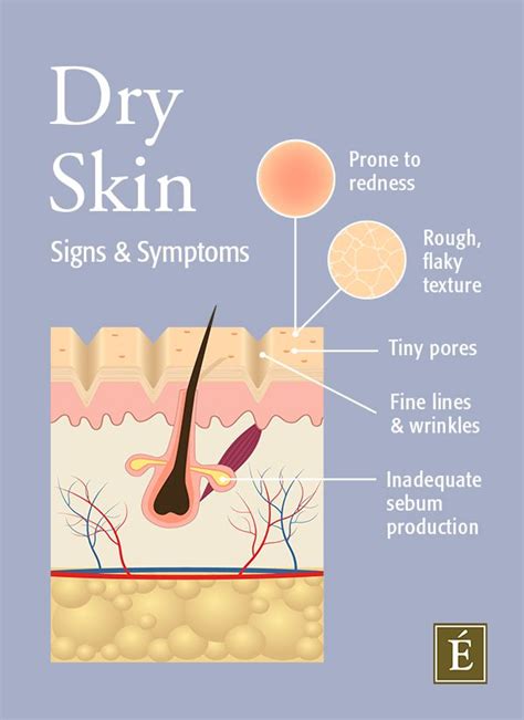 How To Get Rid Of Dry Skin The Ultimate Guide