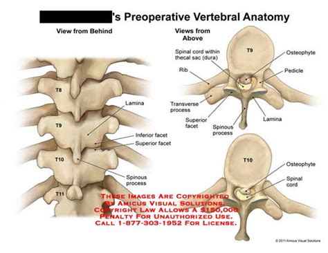 What Is A Facet In Anatomy