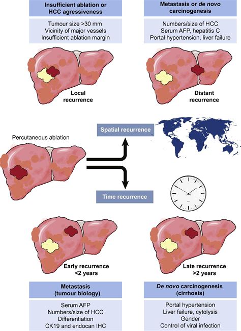 Percutaneous Treatment Of Hepatocellular Carcinoma State Of The Art