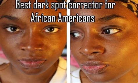 Best Dark Spot Corrector For African Americans Dark Spot Correctors