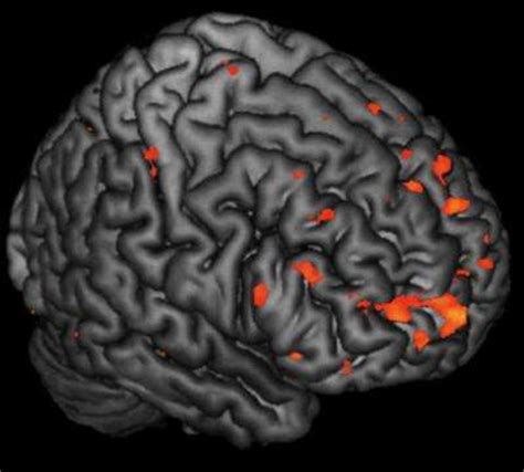 Social cognition and schizophrenia / edited by corrigan p. Alterations in brain activity in children at risk of ...