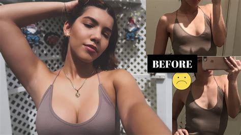 My Boob Job Experience 1 Year Post Op Pt 2 WITH FOOTAGE YouTube