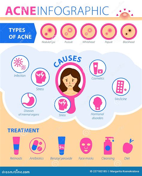 Rosacea Causes Types And Facts Infographics Cartoon Vector