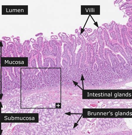 What Is The Histology Of The Duodenum Under The Microscope Homework