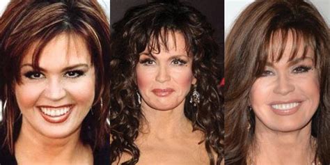 Marie Osmond Plastic Surgery Before And After Pictures 29268 Hot Sex