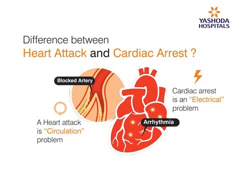 Difference Between Heart Attack And Cardiac Arrest