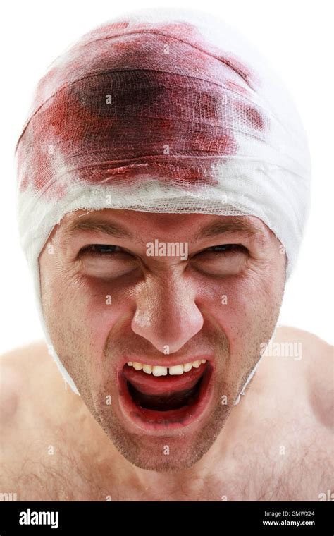 Bandage On Blood Wound Head Stock Photo Royalty Free Image 116124572