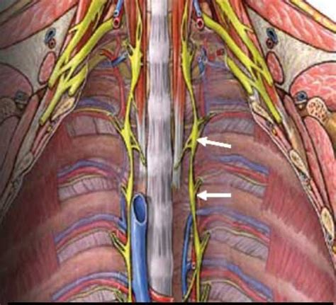 Thoracoscopic VATS Sympathectomy For Hyperhidrosis Department Of Cardiothoracic Surgery