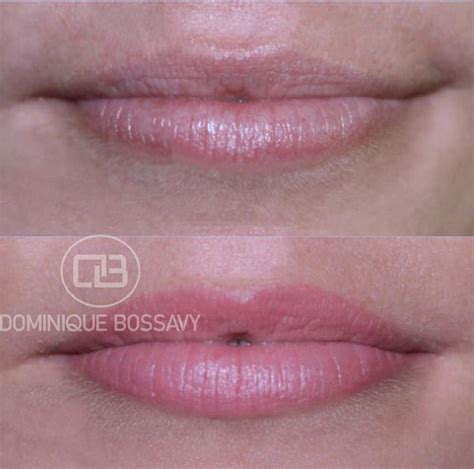 Before After Nano Color Infusion Permanent Makeup For Lips