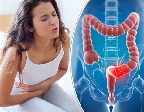 Bowel Cancer Symptoms High Platelet Count Could Increase Risk Health Life And Style