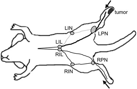 Tumors Alter Lymph Drainage The Lymph Drainage Pattern In The