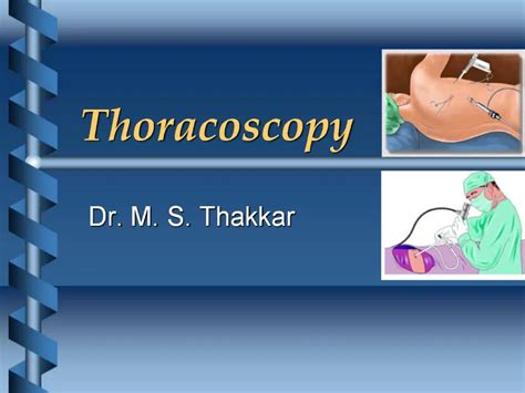 Ppt Thoracoscopy Powerpoint Presentation Free Download Id771395