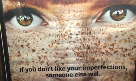 Ad Implies Freckles Are Imperfections Im Not Perfect Freckles Different Colored Eyes