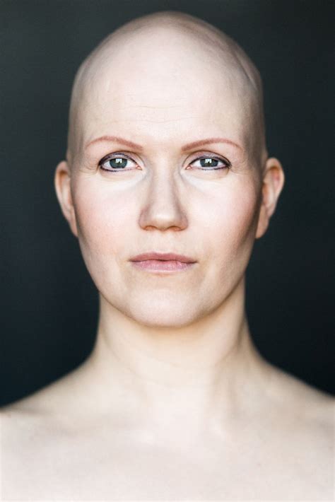 Latest women news, comment and analysis from the guardian, the world's leading liberal voice. Women With Alopecia Captured In Beautiful Pictures ...