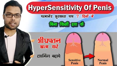 How To Reduce Hypersensitivity Of Penis Sensitive Glans Treatment Dr Nitish Youtube