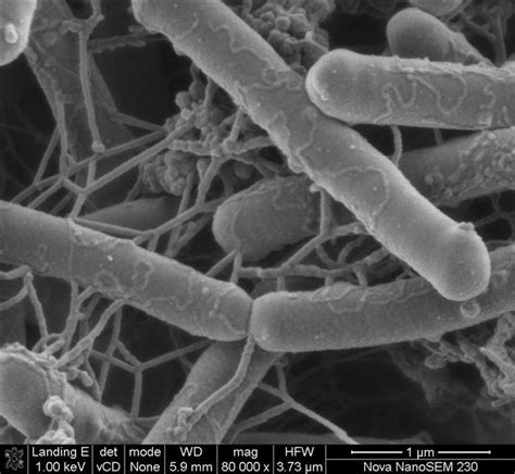 Salmonella form lysine and ornithine decarboxylases, exceptions to this include s. Salmonella Bacteria | Electron Microscope Image from FEI