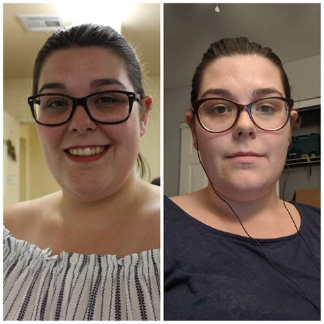 Face Gains Left Is May 2018 And Right Is Today Down 22 Lbs Started