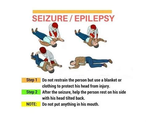 Study Medical Photos Emergency Management Of Seizures Charts