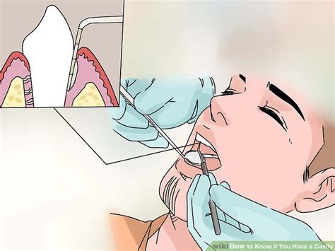 Check spelling or type a new query. 3 Ways to Know if You Have a Cavity - wikiHow