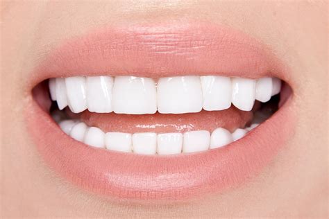 How Do Veneers Change A Tooths Shape And Shade Astoria Ny