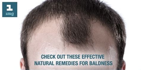 Healthy proteins that are high in fat, like steaks. Will the hair regrow on bald spot with natural treatments ...