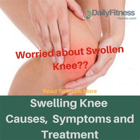 Swelling Knee Causes Pictures Symptoms And Treatment