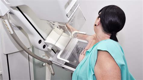 Capixabas Enfrentam Dificuldade Para Realizar Mamografia No Sus